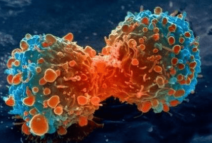 美国科学院院报讯:发现抗癌病毒 杀癌细胞对正