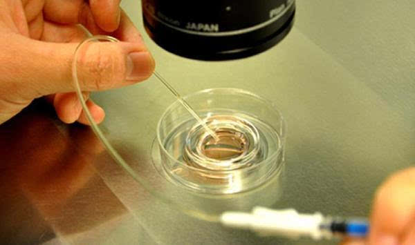 试管婴儿胚胎移植几个比较保险 - 3023.com