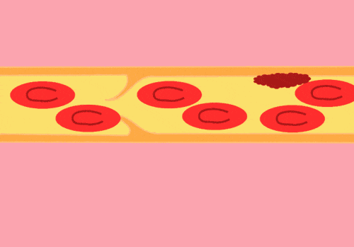 朋友圈最火流言:喝醋软化血管、木耳化血栓?真相在这!