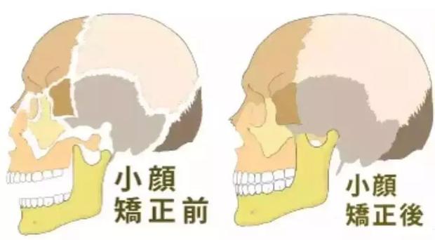成语颜筋什么骨_成语故事简笔画(4)