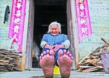 八旬老妇拾柴不穿鞋 冬天双脚也不龟裂 赤脚或为健康长寿秘诀