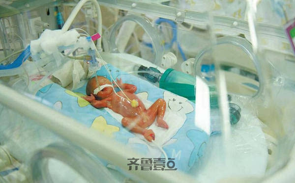 目前孩子已被转入了新生儿科,并连上了呼吸机等救护设备.