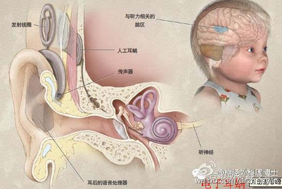 爱耳日科普:探秘大脑之重塑听觉