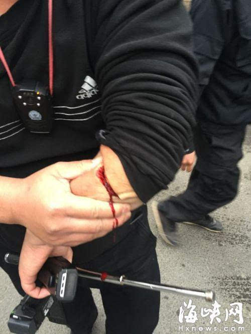 城管执法被摊贩用西瓜刀砍伤手臂缝15针(图)