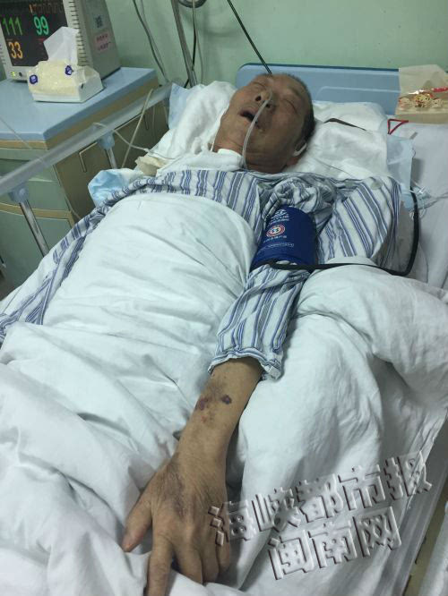 61岁泉港退休教师患脑梗塞昏迷45天 子女盼他早日醒来