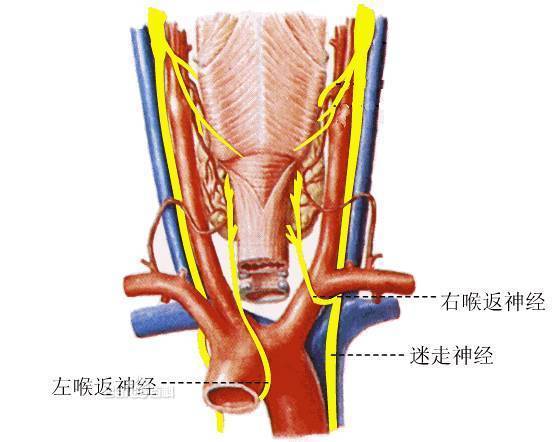 如果甲状腺长了肿瘤,就会压迫喉返神经,也会造成声音嘶哑.