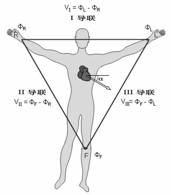 肢体导联(对应心电图的Ⅰ,Ⅱ,Ⅲ导)需要连接患者的左手,右手和左脚正