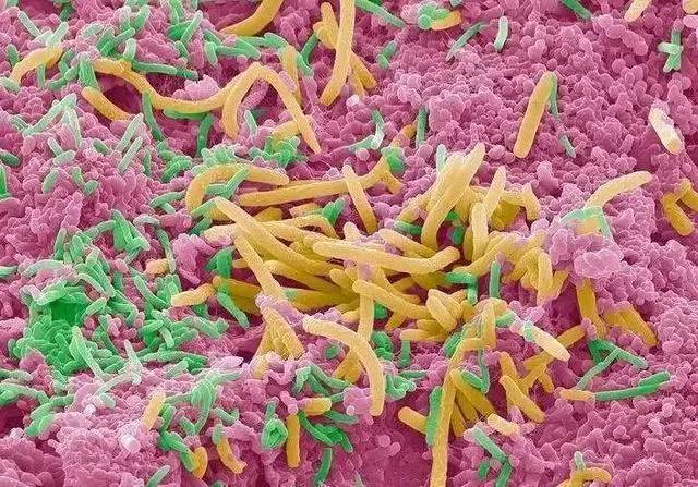用最新显微技术看口腔中细菌微生物的真实模样