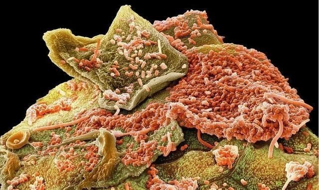 用最新显微技术看口腔中细菌微生物的真实模样