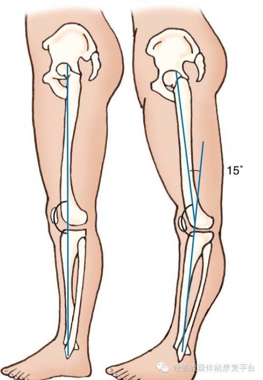 膝关节疼痛探索与发现