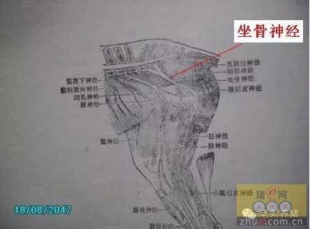 解剖生理 打针的方式有多少种?