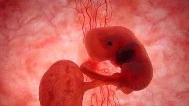 孕70天胚胎停育药流,孩子走好,这一世我们的缘