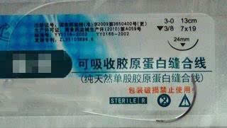 外科:3分钟全面了解可吸收手术缝合线-搜狐