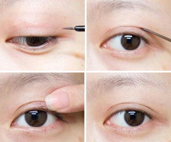 5mm适合塑造比较自然的双眼皮,推荐想要自然妆感双眼皮的人群右边:64