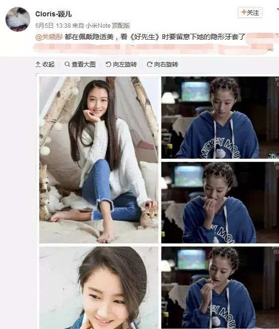 "偷偷"戴牙套 娱乐圈刮起整牙风 "国民闺女"关晓彤在列