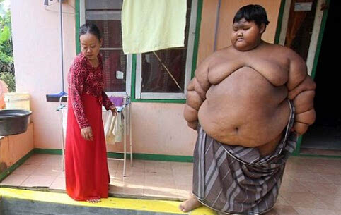 全球最胖男孩10岁达192公斤 儿童肥胖如何减肥