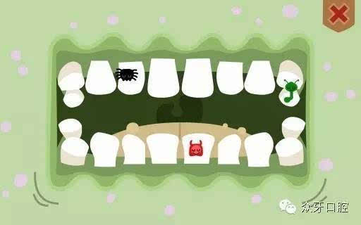 3,如果出现蛀牙,尤其是乳前牙出现蛀牙,就会影响儿童的牙齿美观及发音
