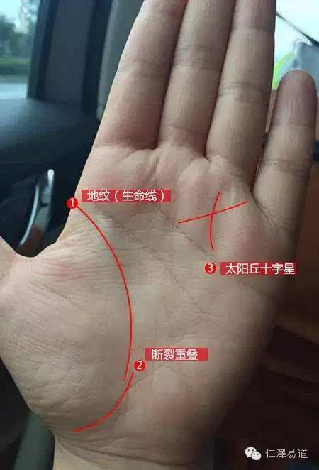 小手指短怎么办