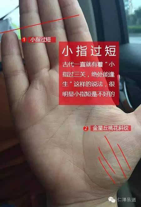 小手指短怎么办