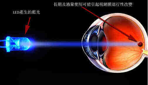 别看VR小电影了!台湾男子每天看2小时致眼球