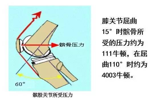 其它 正文  髌骨的受力在伸直位和屈曲位是不同的,屈曲位受的压力较