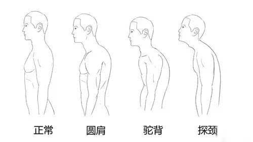 tag信息列表 佝偻