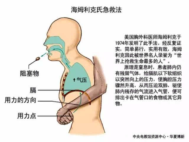 噎着的孩子只有5分钟黄金急救时间,一定要学海姆立克