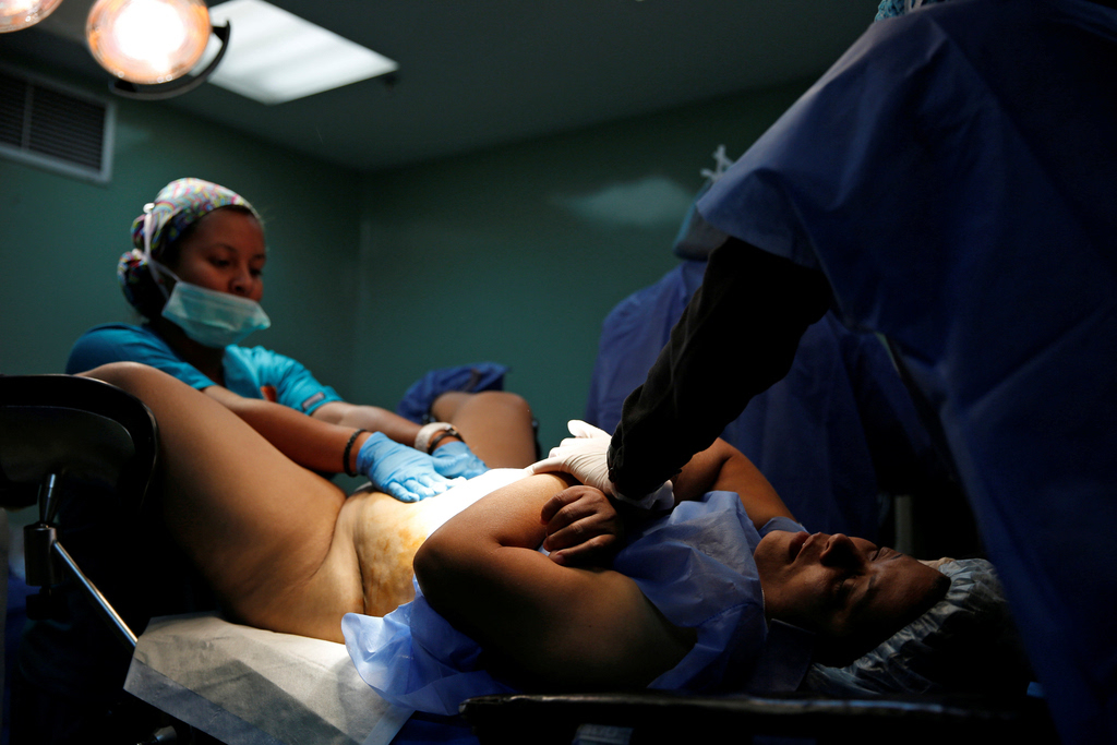 委内瑞拉女性涌向绝育不归路