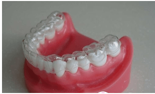 无托槽隐形矫治器 正确正畸治疗告别钢牙套