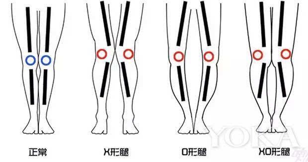 快来瞅瞅你的腿型属于哪种!