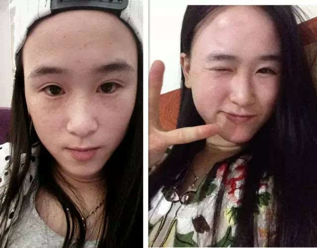 30岁女人脸上黄褐斑怎么调理