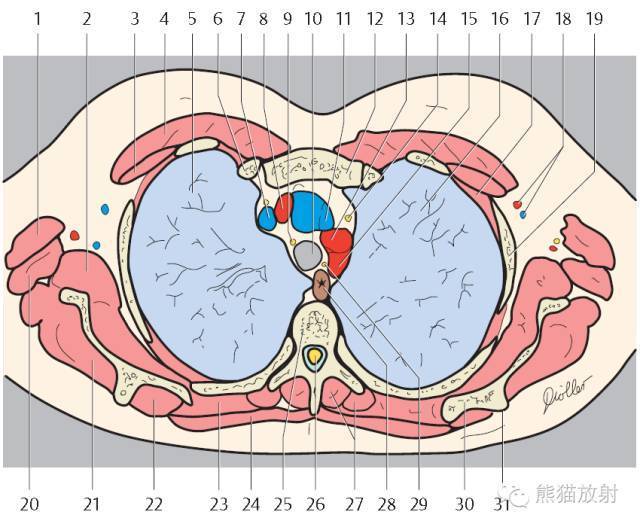 收藏!精美详细的胸部CT断层解剖图(双语)_搜狐