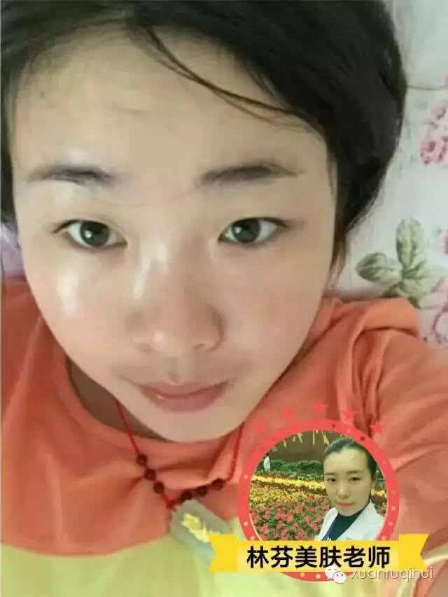 教你养出一张白净小脸,来不及化妆也无妨!