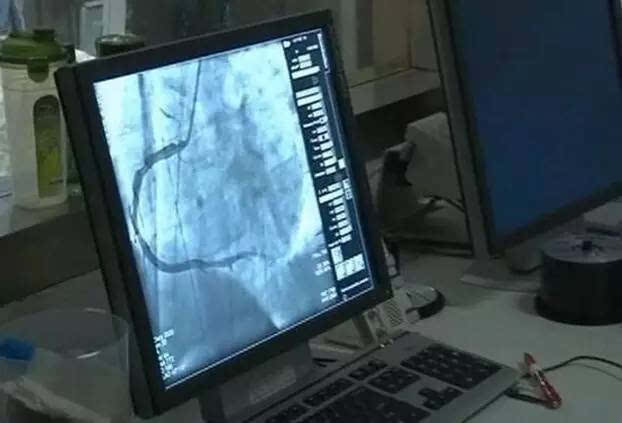 近日,江苏淮安一女子因失恋,过度悲痛导致患上