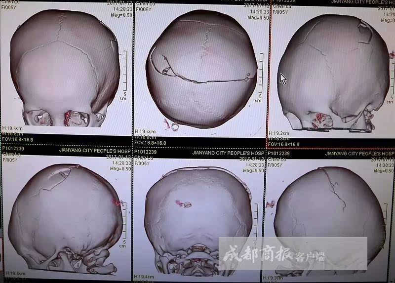 姑父搬起大石头狂砸小姐弟!正在潜逃!抓住他!