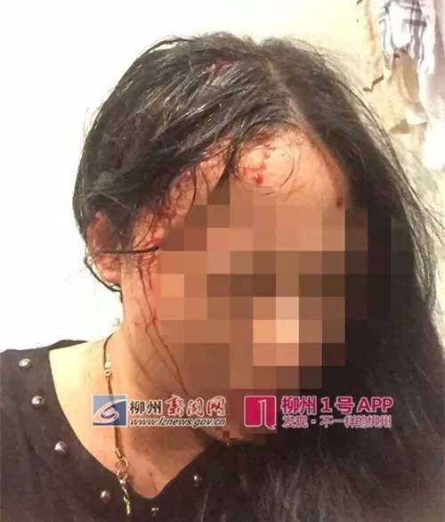 3名中国人在南非旅游遭劫匪枪击一对母女头部中枪