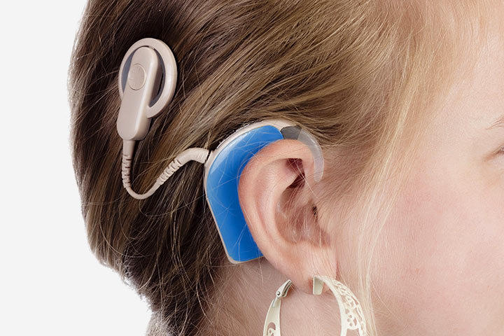 先天性耳聋耳蜗正常耳神经受损可以移植耳蜗吗