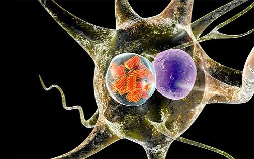 science报道:狂犬病毒或成精准治疗脑癌的"神器"