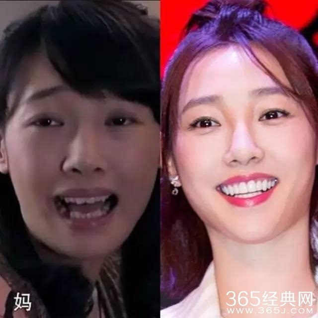 林心如以前做模特的时候,是可爱的小虎牙妹妹.