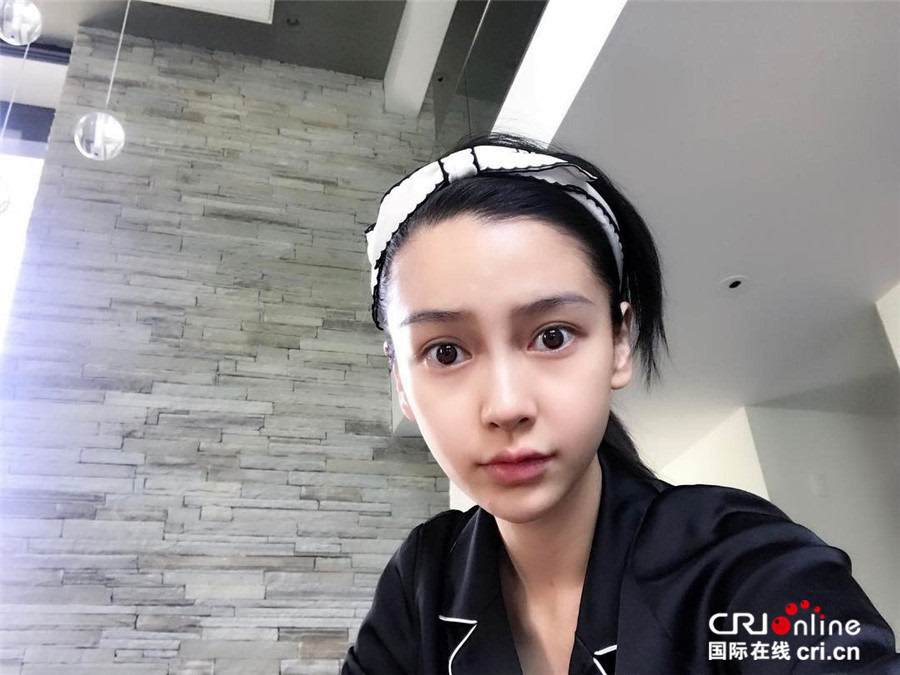赵丽颖佟丽娅杨幂Angelababy 真实皮肤最好的