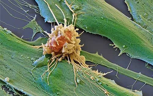 一周资讯回顾:他用DNA测序技术,让百年肿瘤变