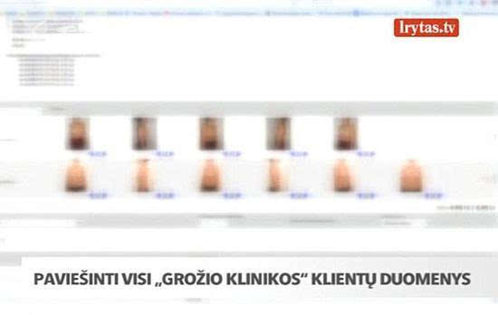 黑客攻击整形医院 25000多张个人隐私包括裸