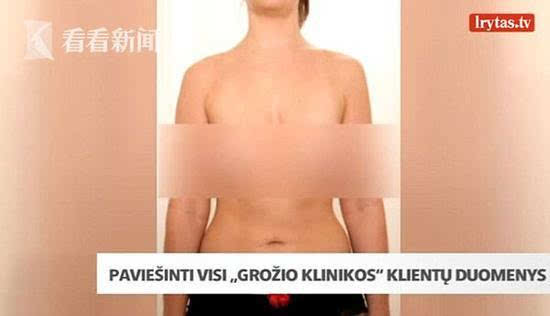 黑客攻击整形医院 25000多张个人隐私包括裸