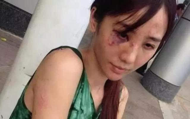 妻子遭10年家暴二胎流产 最后救她的竟是一条微信!