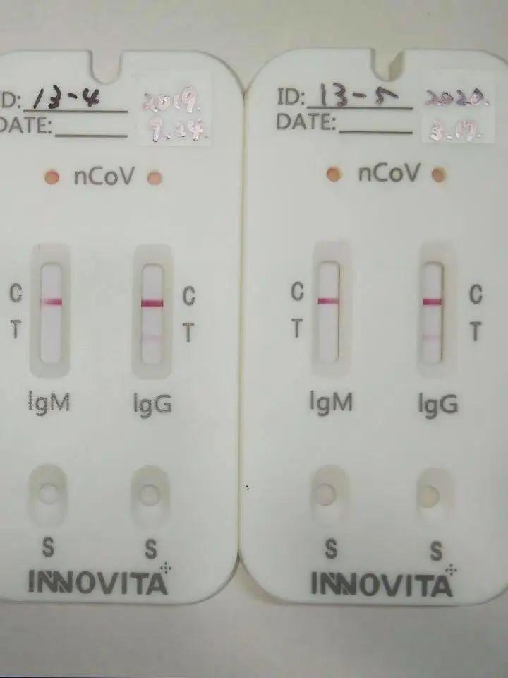 igg阳性igm阴性 5/9补充 为了确认ict套装的精度,于5月8日再次进行