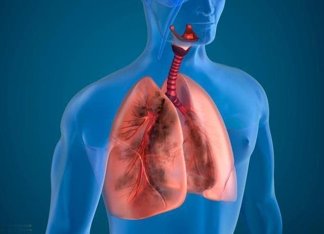 经常吸烟的人要注意,出现这4种情况,可能是肺部受损了