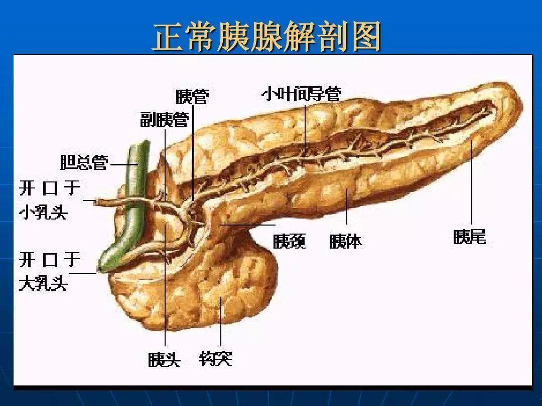 解剖图,黄色器官即胰腺 胰体部接近幽门,肿瘤病灶如果生长在这一部位