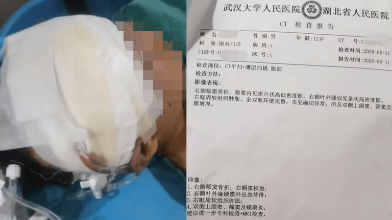 13岁男生被“班主任”殴打昏迷，躺在地上一夜没人管，导火索是一张小纸条