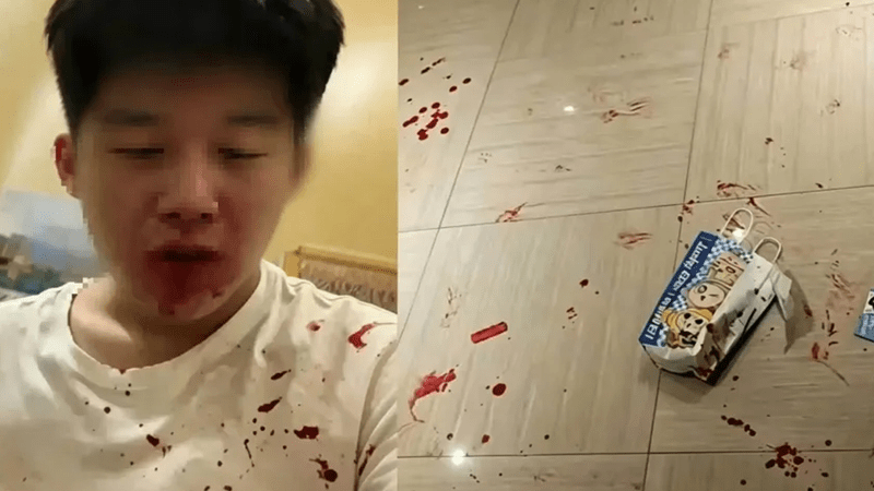 男生被打报警后遭二次殴打，父亲痛心发声：儿子被逼下跪喊爸爸！警方已提级处理