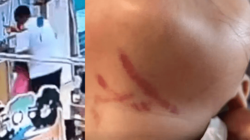 监控曝光！3岁女童疑遭幼儿园男老师暴力喂食，颈部、唇部等多处受伤，家长：园长电话称不小心磕伤